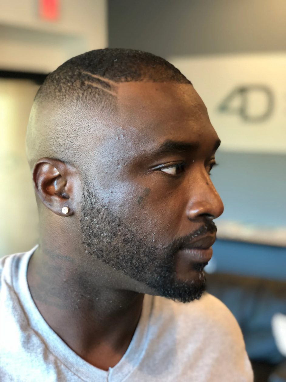 Bald fade with a sharp beard line-up, side profile
